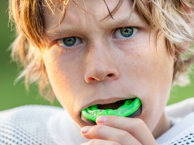 Sports Mouthguards in Lewisville